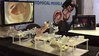 Enhanced Transseptal Mitral Model [upl. by Nylicaj]