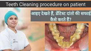 How is teeth cleaning done मशीन द्वारा दातों की सफाई कैसे की जाती है [upl. by Alicirp818]