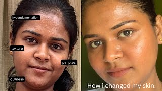 My night skincare routine  textured acne prone skin  Tamil [upl. by Berlyn]