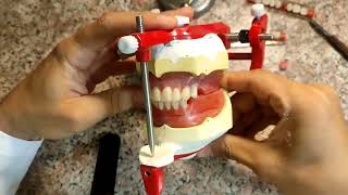 arrangement of posterior teeth in complete dentureClass I [upl. by Ajuna]