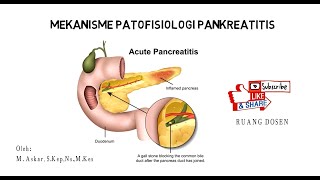 MEKANISME PATOFISIOLOGI PANKREATITIS [upl. by Atinid]