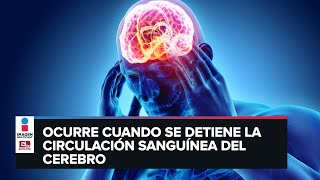 Infarto cerebral Síntomas para detectarlo y causas [upl. by Pandolfi]