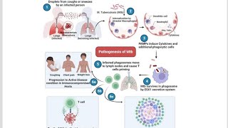 Pathogenesis of Tuberculosis Virulence factors of Mycobacterium tuberculosis and Tuberculin Test [upl. by Aicilehp335]