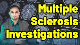 Investigation For Multiple Sclerosis  Homeopathy Treatment amp Cure  Dr Bharadwaz [upl. by Attenol]