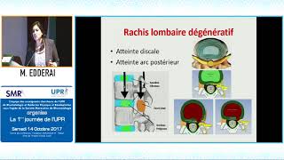 IRM du rachis lombaire pour le rhumatologue Pr M EDDERAI [upl. by Refinneg819]