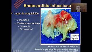 UT6  Endocarditis infecciosa Dr Izaguirre [upl. by Enylcaj]