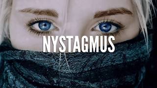 Nystagmus How Do We See It [upl. by Sigismund948]