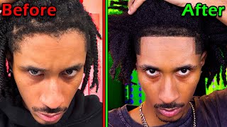 How to give Yourself a TAPERED HAIRLINE [upl. by Dekow228]