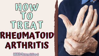 HOW TO TREAT RHEUMATOID ARTHIRITIS RA Signs and Symptoms and Management [upl. by Helas]