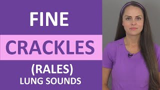 Fine Crackles Rales Lung Sound Causes Breath Sounds Audio Nursing [upl. by Leahcimrej553]