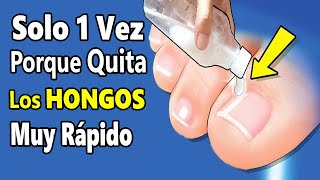 Echa este ACEITE 1 vez en tus PIES con HONGOS o BACTERIAS💅 Adiós HONGOS de las UÑAS en 2 días [upl. by Edlin]