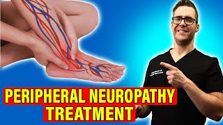 Peripheral Neuropathy Treatment Leg amp Foot Nerve Pain HOME REMEDIES [upl. by Iva]