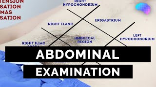 Abdominal Examination  OSCE Guide Latest  UKMLA  CPSA [upl. by Aroon]