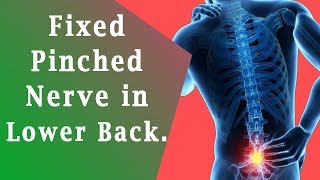 Rehab Exercises for Spine Problems back pain sciatica [upl. by Fiertz195]