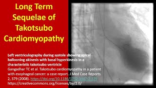 Long Term Sequelae of Takotsubo Cardiomyopathy [upl. by Ahseyk]