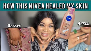 Shocking truth about Nivea vitamin C amp Tumeric body lotion🤯 [upl. by Hako]