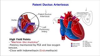 Patent Ductus Arteriosus [upl. by Aivil827]