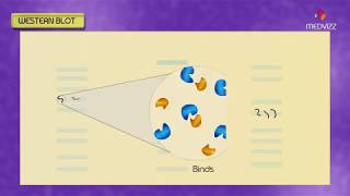 Western blot  Southern blot  Northern blot  South western Blot  Animation [upl. by Ojybbob600]