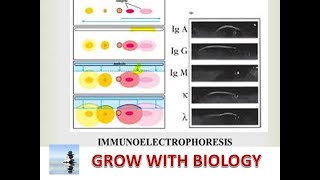 IMMUNOELECTROPHORESIS IN HINDI [upl. by Debbi417]