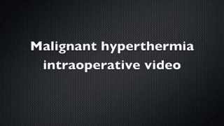 Malignant Hyperthermia Intraoperative video  Case Report [upl. by Sande]