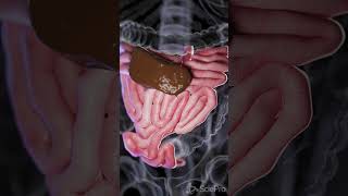 Understanding Small Bowel Perforation anatomy biology 3danimation [upl. by Tnomal]