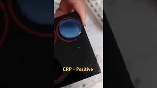 CRP test procedure  CRP blood test  medicalstudent youtube shorts [upl. by Warfore572]