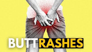 Butt Rashes What You Need to Know [upl. by Iris]