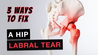 Hip Pain Fix a Hip Labral Tear Fast [upl. by Anaik972]