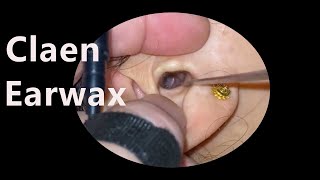 Ear picking tutorial Treat earwax in your ears and relieve stressear earwax pick [upl. by Gabler545]