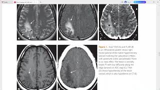 BRAIN IMAGING WITH MRI AND CT [upl. by Turmel845]