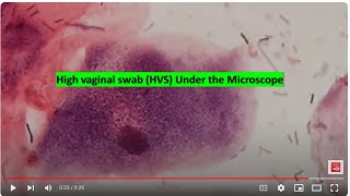 HVS under the microscope [upl. by Rico]