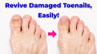 Unlock the Secret to Healthy Toenails with ProNail Complex [upl. by Jak]