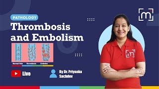 Thrombosis and Embolism with Dr Priyanka Sachdev [upl. by Seema]