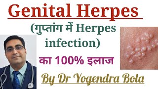 Genital Herpes Infection ke causes  symptoms and 100  treatment in Hindi Acyclovir  famciclovir [upl. by Tann]