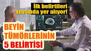 İşte beyin tümörlerinin 5 belirtisi Kalıtsal hastalıklar beyin tümörlerine neden olabiliyor [upl. by Amoakuh222]