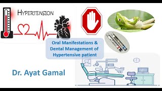 Dental management of hypertensive patients [upl. by Nylhtak]