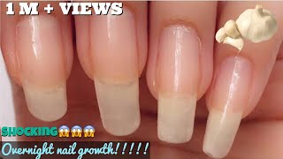 How to Grow Nails in 2 Days  How to Grow Nails Fast [upl. by Ettelohcin]