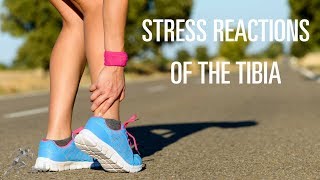 What can you do to recover from a stress reaction of your tibia [upl. by Etnaid]