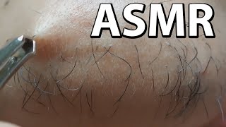 ASMR Plucking facial hair Satisfying  pulling out hairs  with tweezers  chin hair plucking [upl. by Esdras]