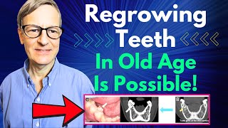 Regrowing Teeth In Old Age Is Possible Human Trial Starts This Year [upl. by Aylad]