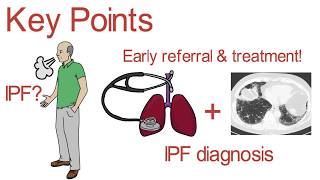 The Importance of Early Referral and Treatment for IPF [upl. by Hayes293]