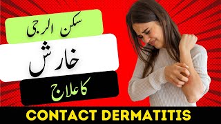 Contact Dermatitis Kharish Ka Ilaj Skin allergy ka ilaj [upl. by Derriey]