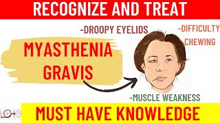 What is Myasthenia Gravis  All you need to know  Causes  Symptoms  Diagnosis  Treatment [upl. by Nwaf]