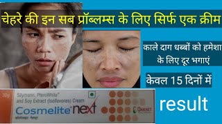 चेहरे के काले दाग धब्बों के लिए बेस्ट क्रीमcosmelite next cream review usesdosageside effects [upl. by Ayenet]