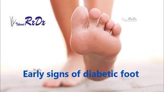 Early Signs of Diabetic Foot [upl. by Baylor]