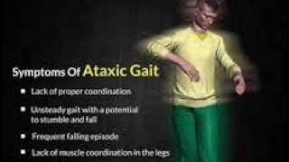 Ataxia Ataxic Gait  the inability to coordinate movement it’s causes and possible treatment [upl. by Arocet711]