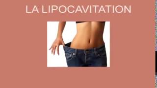 Liposuccion sans chirurgie lipocavitation cellulite et remodelage corporel  voyez les résultats [upl. by Jariv]