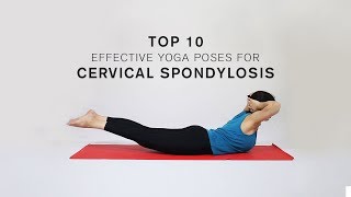 Top 10 Effective Yoga Poses for Cervical Spondylosis [upl. by Nnyliram]