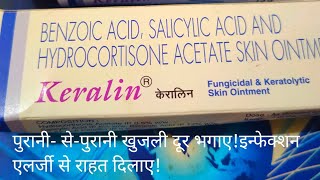 पुराने से पुराने खुजली त्वचा रोग को खत्म करें Keralin Ointment use in psoriasis And Fungicidal [upl. by Vasti]