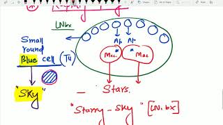 BURKITT s Lymphoma by Dr Devesh Mishra [upl. by Emiolhs]